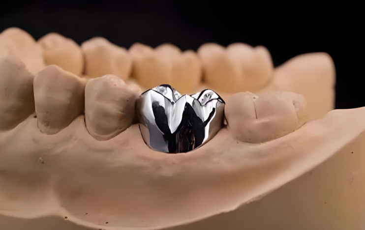 Titanium alloy and zirconia dental implants: What is the difference?