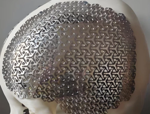 Tibbiy titanium qotishma mash narxi